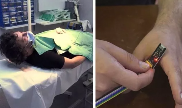 Türk YouTuber Derisinin Altına NFC Çipi Yerleştirdi