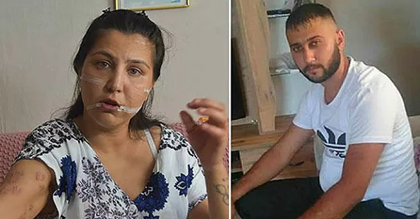 104 Yerinden Bıçakladığı Kadının Başında Sigara İçti