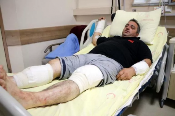 Tokatlı Çiftçi Ayıyla Güreşti: Bir de Siz Ayıyı Görün
